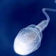 Image for article titled Is The Internet Killing Sperm?